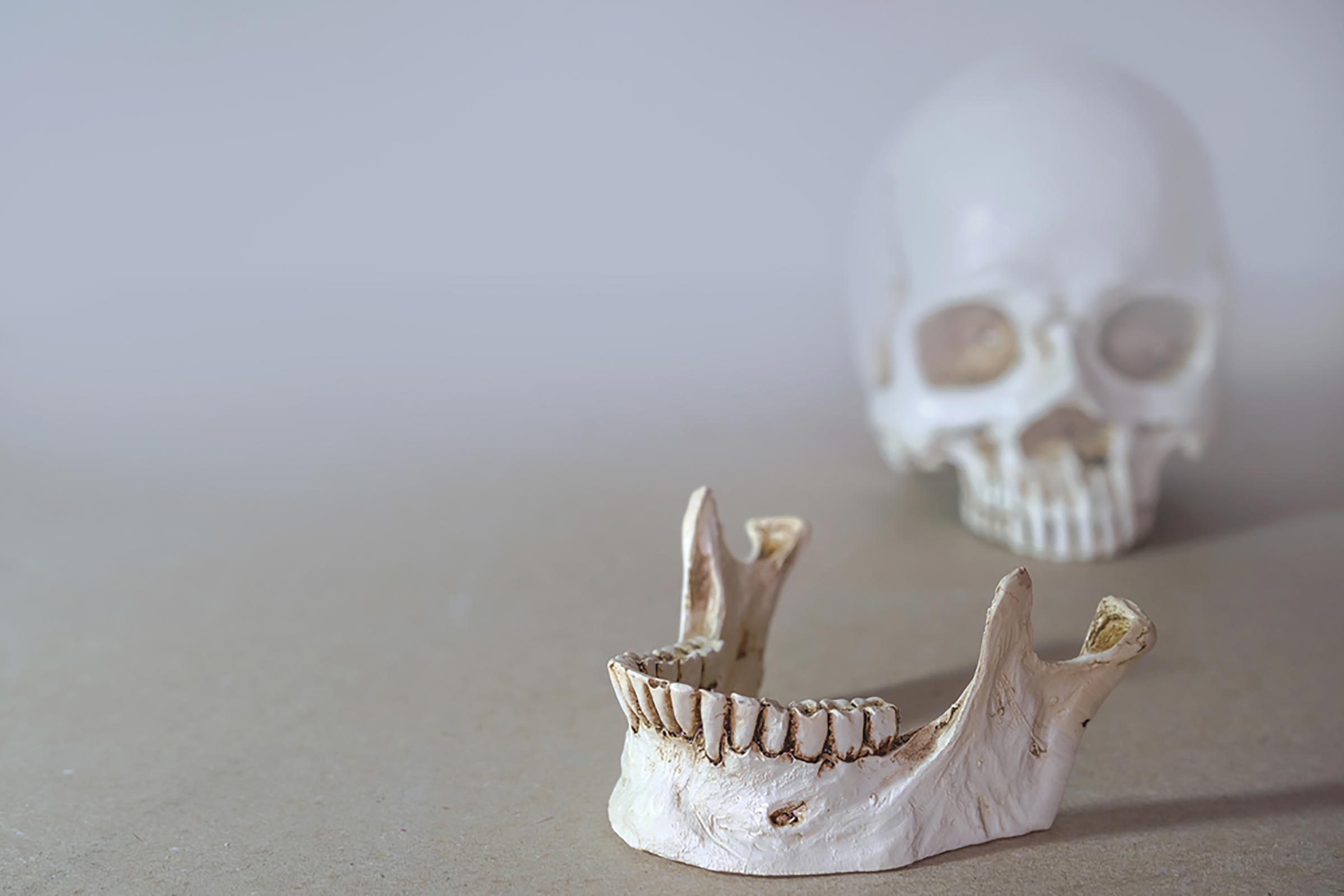 skeletal jaw and skull, separated.