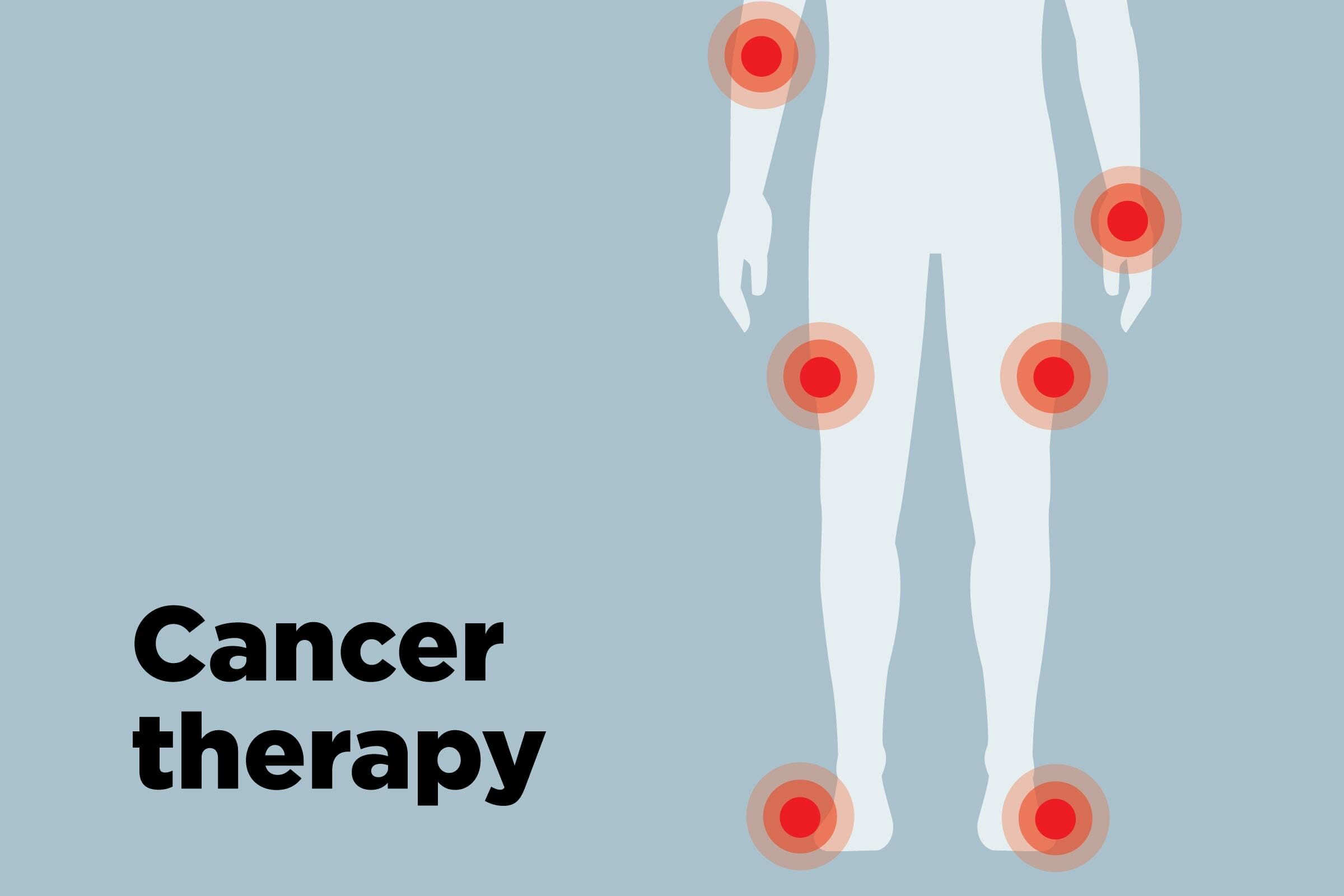 outline of body showing cancer therapy hotspots