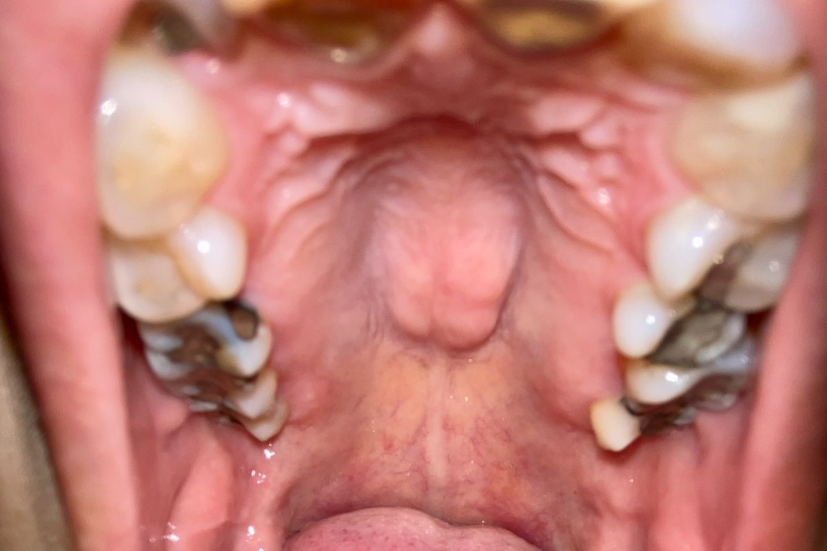 close up of roof of mouth