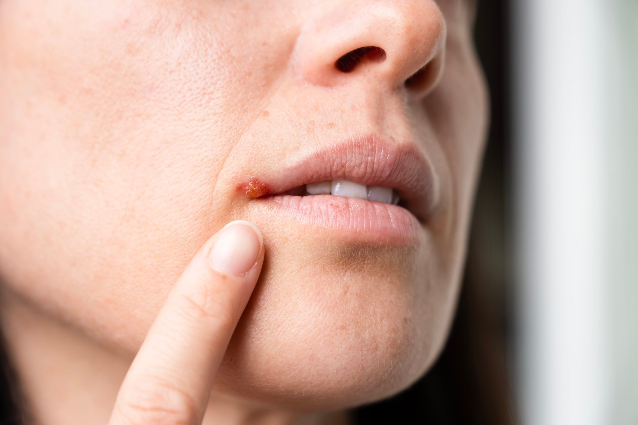 Research: Being Infected with This Surprising Virus Could Increase Your Alzheimer’s Risk