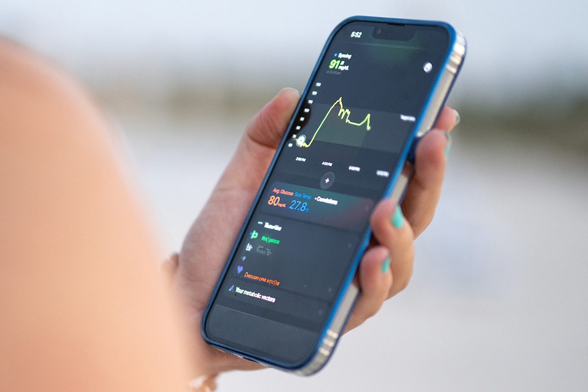 Continuous Glucose Monitors 