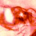 'Here's How I Knew I Had Swimmer's Ear': It's Not Your Average Ear Infection, a Patient and Doctor Share