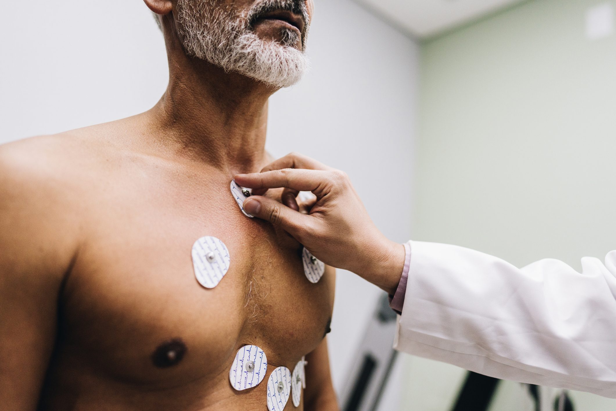 Close-up of human hands putting sensors of electrocardiography on a doctor's office